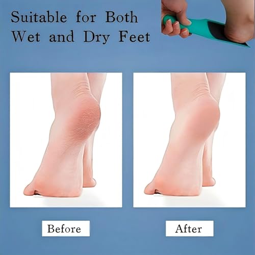 U-Shaped Curved Foot File Dead Skin Callus Remover Scrubber | Double-Sided, Dead Skin Callus Remover, Foot Scrubber for Wet and Dry Feet, Curved Design for Full Heel & Side Exfoliation