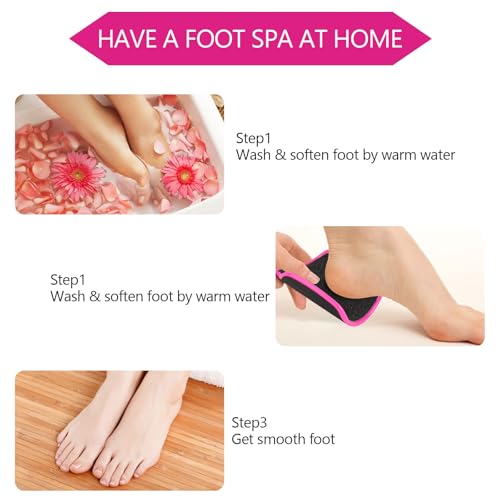 2 Pcs Curved Foot File Callus Remover for Feet, U Shaped Foot Scrubber Dual Sided Heel File Scraper Dead Skin Remover - color: Rose Pink&yellowish
