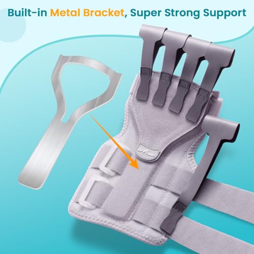 Radial Nerve Palsy Splint Brace for Wrist drop, 5 Fingers Extension, Stroke Patient Recovery, Finger Limp, Crutch Palsy, MCP Arthroplasty, for both Left and Right Hand - Gray - color: Gray
