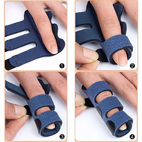 Upgraded Finger Splints (4Pcs), Trigger Finger Splint Finger Brace with 3 Fixing Strap for Mallet Finger, Broken Finger Protector, Knuckle Immobilization, Straightening Support, Arthritis Pain Relief - color: Multi