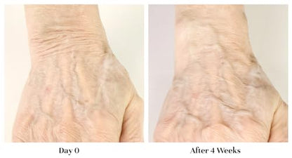 City Beauty Restoring Hand Treatment - Moisturizing Hand Cream - Dry Hand Relief - Solution for Wrinkled, Crepey Hands & Dark Spots - Wash-Resistant - Anti-Aging Cruelty-Free Skin Care