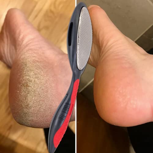 Made in Germany Double Sided Metal Foot File - Stainless Steel Feet Callus Remover - Feet Scrubber Dead Skin - Heel Scraper Cracked Heels Repair Professional Foot Rasp. - style: Stainless Steel