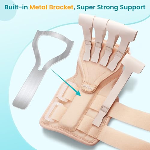 Radial Nerve Palsy Splint Brace for Wrist drop, 5 Fingers Extension, Stroke Patient Recovery, Finger Limp, Crutch Palsy, MCP Arthroplasty, for both Left and Right Hand - Beige - color: Beige