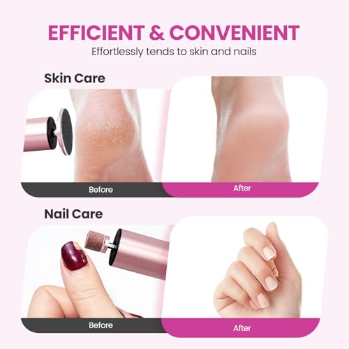 Electric Foot Callus Remover, 2 in 1 | 6 Speed Adjustable Foot File Nail Grinder with Sandpaper Disks, Professional Sander Pedicure Tool for Feet Dead Skin, Self Care Gifts for Women Mom Lover Friends - style: Electric Callus Remover Rose
