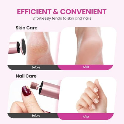 Electric Foot Callus Remover, 2 in 1 | 6 Speed Adjustable Foot File Nail Grinder with Sandpaper Disks, Professional Sander Pedicure Tool for Feet Dead Skin, Self Care Gifts for Women Mom Lover Friends - style: Electric Callus Remover Rose