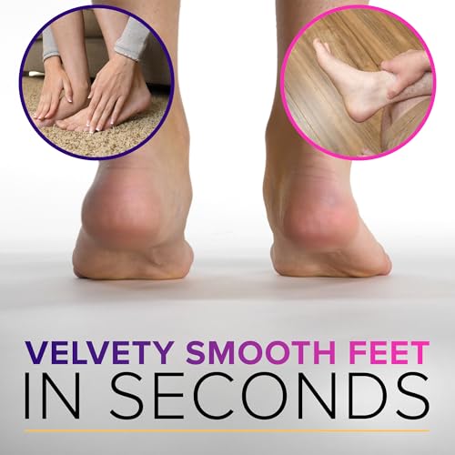 NYK1 RUSTPROOF Foot File Callus Remover for Feet with Catcher | XL Size | MegaFile Hard Skin Remover Foot Scraper for Wet and Dry Use - Non-Slip Textured Grip for Smooth, Soft & Callus-Free Feet