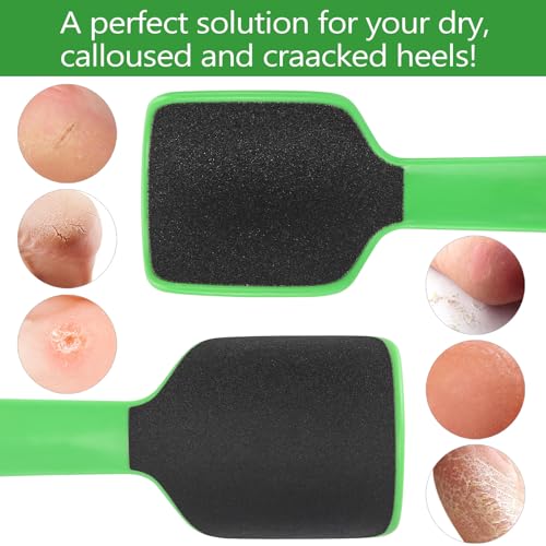 2 Pcs Curved Foot File Callus Remover for Feet, Double Sided Heel File Scraper U Shaped Foot Scrubber Dead Skin Remover - color: Green&yellowish