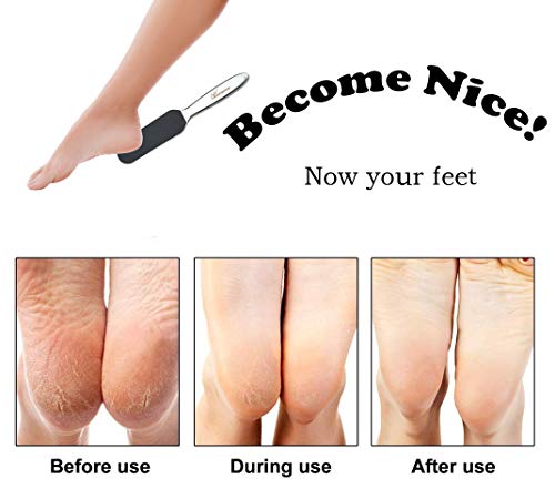 Professional Pedicure Foot File - Reusable Stainless Steel Cracked Skin Corns Callus Remover Feet Rasp - size: 1 Count (Pack of 1)