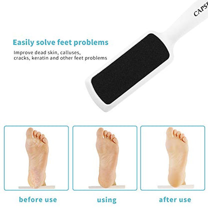 Pedicure Foot Rasp File Callus Remover, Double-Sided Colossal Foot Rasp Foot File And Callus Remover For Dead Skin (Pack of 4) - size: 1 Count (Pack of 4)