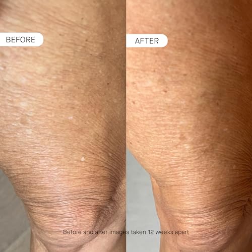 oneskin OS-01 BODY Topical Supplement Moisturizer | Age Reversal, 8.45 Oz | Fragrance-free body moisturizer targets thin, crepey skin. Hydrates, firms the look of skin and supports barrier