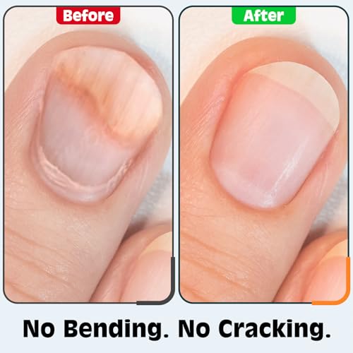 Nail Clippers Set, Fingernail and Toenail Clipper Cutters Kit | Ultra Sharp All-IN-ONE Kit: 15% Thicker Premium Sturdy Podiatrist Toe Nail Care Tools. Perfect Grooming Gifts with Case - color: Black, size: 3-Pack