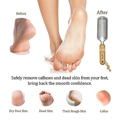 Foot Rasp Callus Remover - Pedicure Scrubber for Cracked Feet, Heel - Professional Stainless Steel File - Remove Dead Skin Corns with Wooden Handle - style: Fine-Grained Rasp