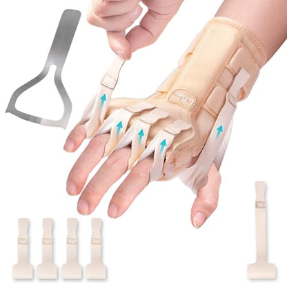 Radial Nerve Palsy Splint Brace for Wrist drop, 5 Fingers Extension, Stroke Patient Recovery, Finger Limp, Crutch Palsy, MCP Arthroplasty, for both Left and Right Hand - Beige - color: Beige