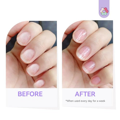 SAVILAND 3-in-1 Nail Strengthener Kit: Ultra Repair Nail Growth and Strengthener with Vitamin E Castor Oil Nail Strengthener for Damaged Nails Care Kit for Repairing Nourishing Weak Brittle Nail Home