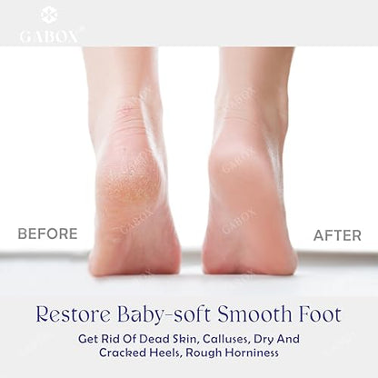 GABOX Nano Glass Pro Foot File, Feet Callus Remover, Dead Skin Exfoliator | Heel & Foot Scrubber, Pedicure SPA Tool for Women & Men, Removedor de Callos en Los Pies, Crystal Green - style: Crystal Green