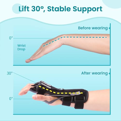 Radial Nerve Palsy Splint Brace for Wrist drop, 5 Fingers Extension, Stroke Patient Recovery, Finger Limp, Crutch Palsy, MCP Arthroplasty, for both Left and Right Hand - Black - color: Black