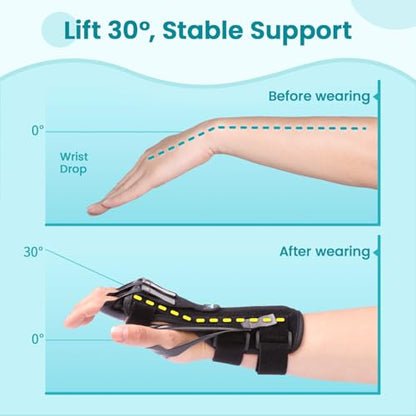 Radial Nerve Palsy Splint Brace for Wrist drop, 5 Fingers Extension, Stroke Patient Recovery, Finger Limp, Crutch Palsy, MCP Arthroplasty, for both Left and Right Hand - Black - color: Black