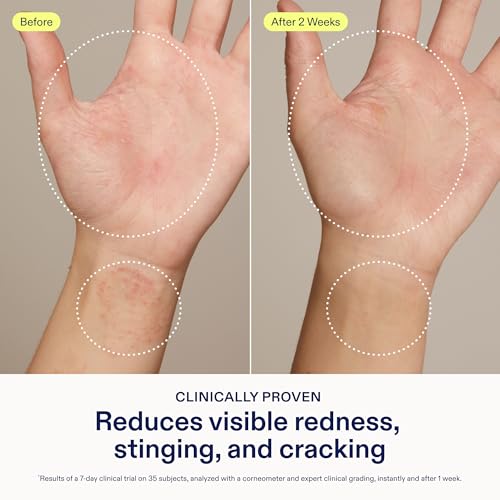 Skinfix Hand Relief Cream - 3 fl oz - Reduces Visible Redness, Stinging & Cracking for Dry, Sensitive Skin - Accepted by the National Eczema Association - Fragrance Free - Vegan, Cruelty Free