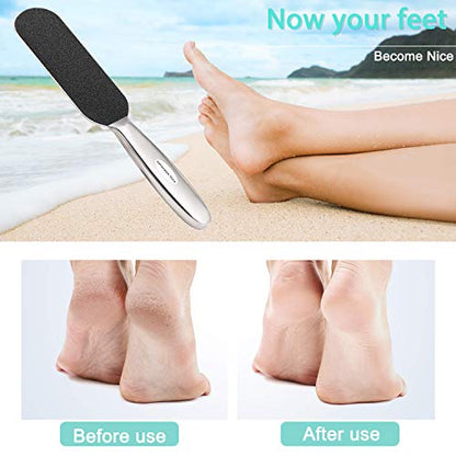 Professional Pedicure Foot File,Coarse/Fine Double Side and Reusable Stainless Steel Cracked Skin Corns Callus Remover Feet Rasp - size: Coarse/Fine Double Side
