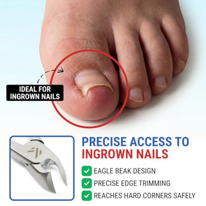 Toenail Clippers for Thick Toenails – KLIPP 15 mm Wide Jaw Thick Fingernail and Toenail Cutter with Curved Stainless-Steel Blades for Seniors (Eagle Beak) - size: Eagle Beak