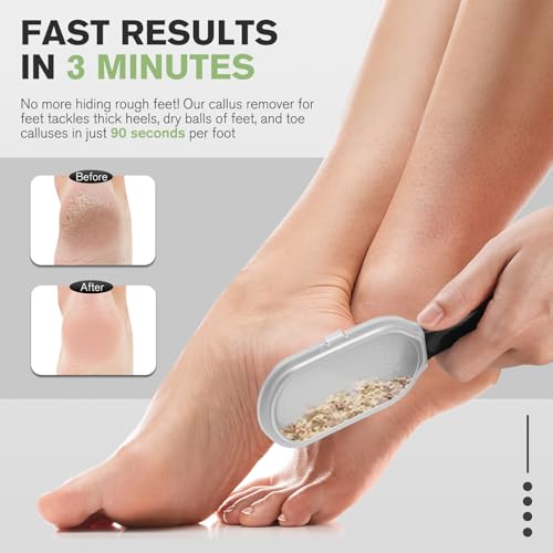 FERYES Foot File Callus Remover with Dead Skin Catcher – The Genius Foot Scrubber for Mess-Free Pedicures, Heel Scraper for Cracked Heel Treatment, Wet & Dry Use Feet Rasp - Black - style: Stainless Steels with Catcher