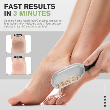 FERYES Foot File Callus Remover with Dead Skin Catcher – The Genius Foot Scrubber for Mess-Free Pedicures, Heel Scraper for Cracked Heel Treatment, Wet & Dry Use Feet Rasp - Black - style: Stainless Steels with Catcher