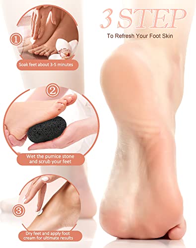 Maryton Natural Pumice Stone for Feet - Lava Foot Exfoliator Scrubber Pedicure Tools, Dead Skin Corn Callus Remover for Feet and Hands, 2 Count - style: 2pcs Pumice Stone