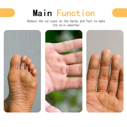 Callus Remover for Hands,Hands & Feet Callus File with 3 Grit Sandpapers (100/180/400), Durable Hand Callus Shaver for Crossfit, Climbing, Woodworking,Rock Climbing Gifts