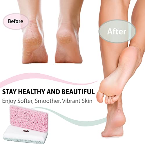 Siliglass Pumice Stone Callus Remover for Feet, Elbows, Hands, and Knees, Spain Made - 2 in 1 Pedicure Exfoliator and Scrubber for Rough, Hard Skin (1 Pack) - style: Pink - 1 Count