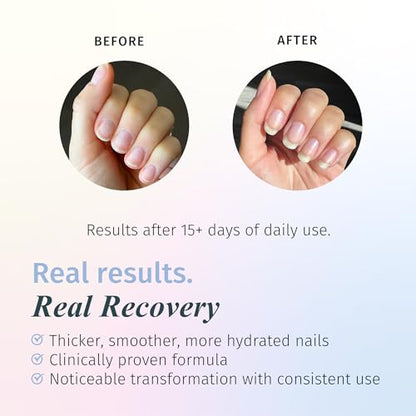 Duri Rejuvacote 1 Nail Growth System + 791 Berry Margarita Neon Purple Nail Polish Bundle - Nail Strengthener & Bold Semi-Matte Color Duo, Summer Manicure Set, 0.45 Fl Oz Each - color: Berry Margarita + Rejuvacote 1 (Pack of 2)