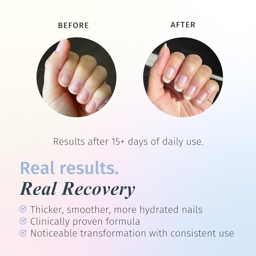 Duri Rejuvacote 1 Nail Growth System + 600 Dream Catch Light Orange Nail Polish Bundle - Nail Strengthener & Glossy Peach Color Duo, Warm-Weather Manicure Set, 0.45 Fl Oz Each - color: Dream Catcher + Rejuvacote 1 (Pack of 2)