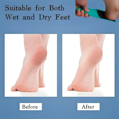 U-Shaped Curved Foot File Dead Skin Callus Remover Scrubber | Double-Sided, Dead Skin Callus Remover, Foot Scrubber for Wet and Dry Feet, Curved Design for Full Heel & Side Exfoliation