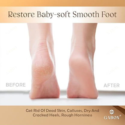GABOX Nano Glass Pro Foot File, Feet Callus Remover, Dead Skin Exfoliator | Heel & Foot Scrubber, Pedicure SPA Tool for Women & Men, Removedor de Callos en Los Pies, Crystal Gold - style: Crystal Gold