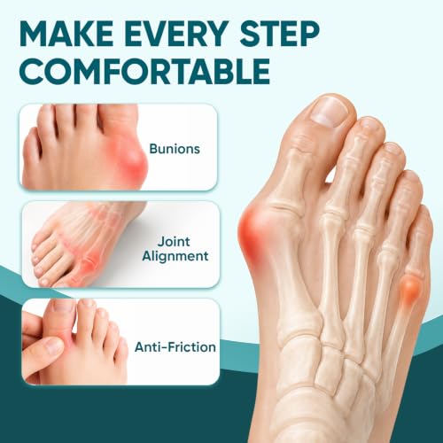TEAWOO Pre-Cut Kinesiology Tape for Bunion, 40PCS Bunion Corrector Tape for Big Toe Discomfort Relief & Joint Support, Breathable Hypoallergenic Latex-Free (Beige & Black)