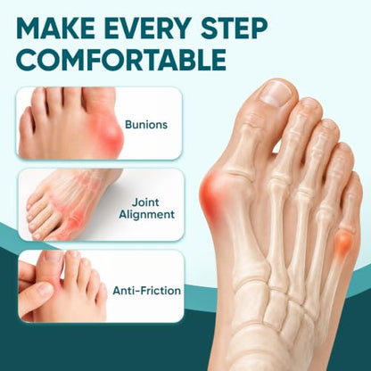 TEAWOO Pre-Cut Kinesiology Tape for Bunion, 40PCS Bunion Corrector Tape for Big Toe Discomfort Relief & Joint Support, Breathable Hypoallergenic Latex-Free (Beige & Black)