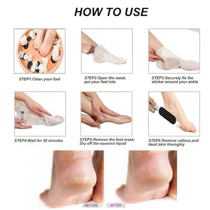 Stainless Foot File Callus Remover for Cracked Heels & Dead Skin — Pedicure Rasp with 10 Replacement Pads & 2 Exfoliating Foot Masks, Sandal Season Foot Care Kit (3in1 Set)
