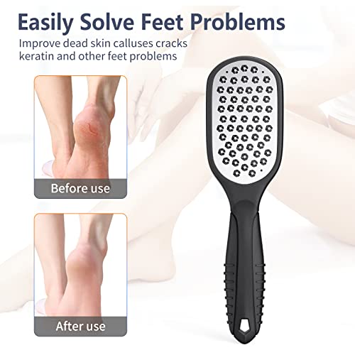 Foot Rasp Foot File and Callus Remover. Professional Foot Care Pedicure Stainless Steel File to Remove Hard Skin. Can Be Used On Both Wet and Dry Feet. -AsonTao