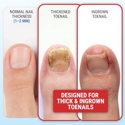 Toenail Clippers for Thick Toenails – KLIPP 15 mm Wide Jaw Thick Fingernail and Toenail Cutter with Curved Stainless-Steel Blades for Seniors (Eagle Beak) - size: Eagle Beak