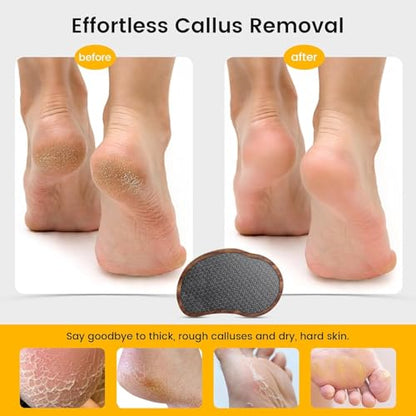 BEZOX Glass Foot File - Nano-Glass Pumice Stone Foot Scrubber, Heel File Callus Remover for Silky Smooth Feet, Portable Pedicure Tool for Summer & Vacation - Walnut Wood Handled