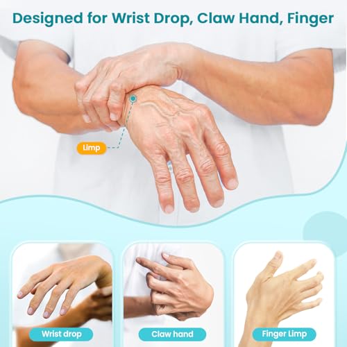 Radial Nerve Palsy Splint Brace for Wrist drop, 5 Fingers Extension, Stroke Patient Recovery, Finger Limp, Crutch Palsy, MCP Arthroplasty, for both Left and Right Hand - Beige - color: Beige