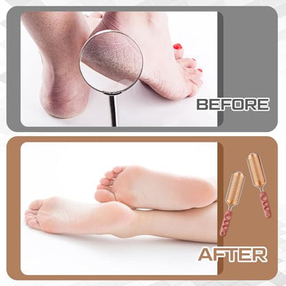 Moxweyeni 14 Pack Colossal Foot File Pedicure Tool Set with 2 Style Large and Small Hole Replacement Callus Remover Blades Rose Gold Stainless Steel Detachable Pedicure Foot Rasp for Dead Skin Remover - color: Rose Gold