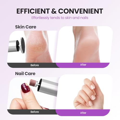 2-in-1 Electric Callus Remover for Feet, Professional Pedicure Tool Gift | 2 Hours Operation | 6 Gears Adjustable Foot File | 1200mAh Rechargeable | 20 Sandpapers | Self Care Gifts for Women Mom Lover - style: 03-Electric Callus Remover Sliver