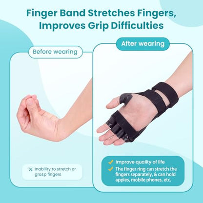 Radial Nerve Palsy Splint Brace for Wrist drop, 5 Fingers Extension, Stroke Patient Recovery, Finger Limp, Crutch Palsy, MCP Arthroplasty, for both Left and Right Hand - Black - color: Black