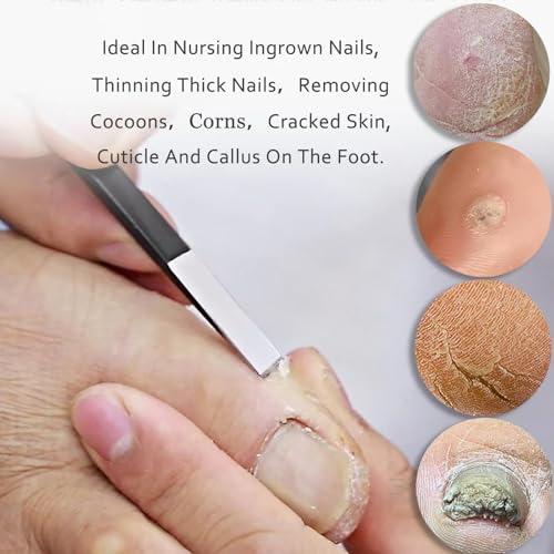 Professional Callus Knife Pedicure Knife for Feet Ingrown Toenail Knives Cuticle Foot Care Tools Dead Skin Removal Nail File Scraper - size: 7 Count (Pack of 1)