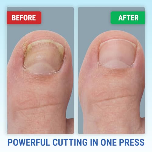 Toenail Clippers for Thick Toenails – KLIPP 15 mm Wide Jaw Thick Fingernail and Toenail Cutter with Curved Stainless-Steel Blades for Seniors (Eagle Beak) - size: Eagle Beak