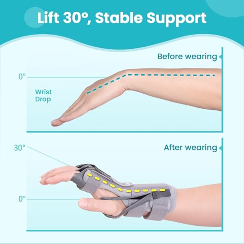 Radial Nerve Palsy Splint Brace for Wrist drop, 5 Fingers Extension, Stroke Patient Recovery, Finger Limp, Crutch Palsy, MCP Arthroplasty, for both Left and Right Hand - Gray - color: Gray