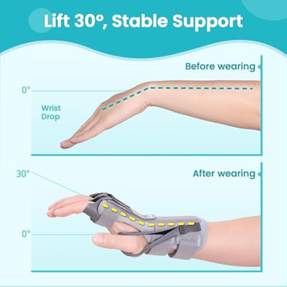 Radial Nerve Palsy Splint Brace for Wrist drop, 5 Fingers Extension, Stroke Patient Recovery, Finger Limp, Crutch Palsy, MCP Arthroplasty, for both Left and Right Hand - Gray - color: Gray