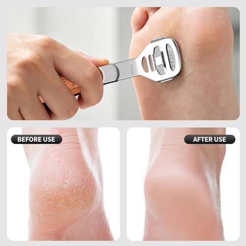 Foot Care Pedicure Callus Shaver Hard Skin Remover Wood Handle 70 Blades | Professional callus remover for hard skin, wood handle grip, includes 70 replacement blades for long-lasting pedicure care.