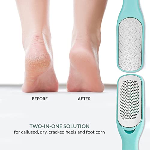 Callus Remover - Dual-Sided Foot File Pedicure Kit | Wet & dry foot scrubber for dead skin - dual-sided rasp & file for smooth heels - pedicure tool for callus & rough skin
