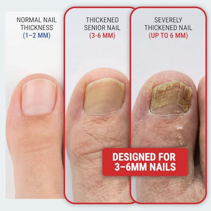 Toenail Clippers for Thick Toenails – KLIPP 15 mm Wide Jaw Thick Fingernail and Toenail Cutter with Curved Stainless-Steel Blades for Seniors (Angled Wide Opening) - size: Angled Wide Opening